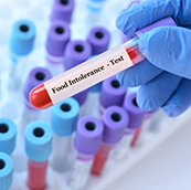 Test intolleranze alimentari